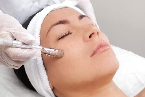 Microneedling